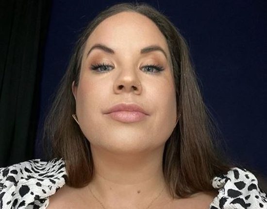 MBFFL Does Whitney Have Something Wrong With Her Face