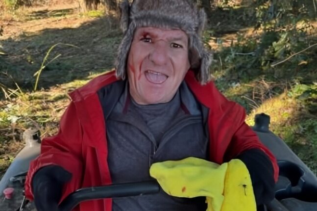 Matt Roloff After The Battle Of The Brambles – Instagram