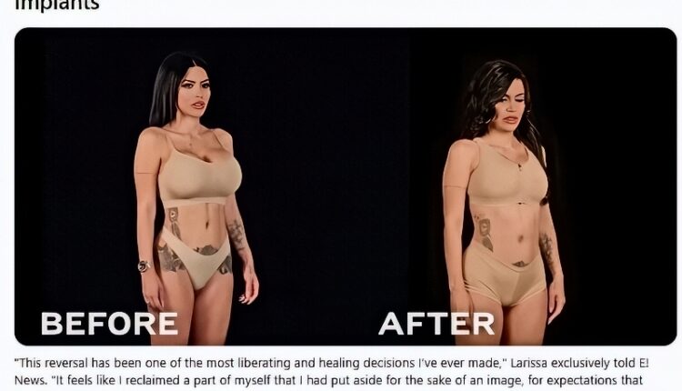 Larissa before and after – E Entertainment via Reddit